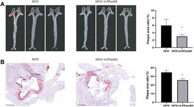 4′-phosphopantetheine acts as a potential antioxidant to limit atherosclerotic plaque formation by inhibiting ROS generation